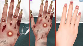 Asmr Animation hand Insect injury removal