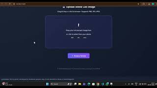 AI Based Malaria Detection Using Image Processing | Machine Learning Project