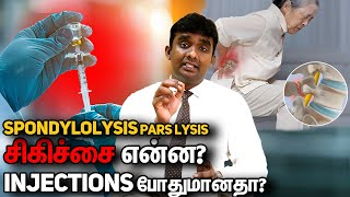 L45 L5S1 Spondylolisthesis Part 8 சிறு வயதில் பாதிப்பு ஏற்படுமா?