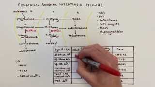 Congenital Adrenal Hyperplasia (CAH) - 2 of 2