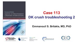 Case 113: PCI Manual - DK crush troubleshooting 2