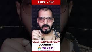 #AskDrJohnWatts | DAY - 57 of VIJAY’S HAIR TRANSPLANT JOURNEY | #besthairtransplant #drjohnwatts