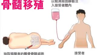 高中生物【教學視訊】焦點 190  先天免疫缺乏：