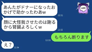 私の顔に大怪我をさせた姉が病気で倒れ、臓器提供が必要になり「あなたの腎臓をちょうだいw」と言った→私が適合者だと知った彼女の反応がwww