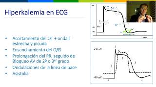 alteraciones ECG en trastornos electroliticos