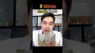 5 วิธีกำจัดปัญหาตีนเหม็น 🦶🏻