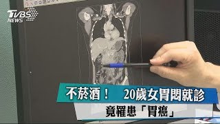 不菸酒！　20歲女胃悶就診　竟罹患「胃癌」