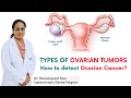 Types of ovarian tumors in Hindi  | How to detect Ovarian Cancer | Healing Hospital Chandigarh