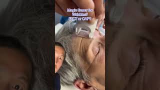 Is This Magic Eraser For Wrinkles Fact Or Cap Factorcap