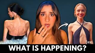 Why Does Every Celebrity Suddenly Look So Thin?