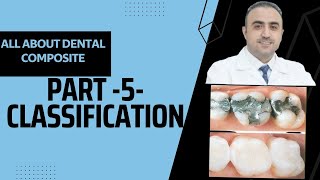 5- حشوات الكومبوزيت: الدليل الكامل لأطباء الأسنان | Dental Composite Classification