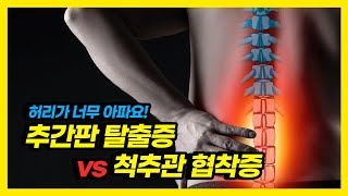 허리 통증 정체는? 추간판 탈출증, 척추관 협착증 구분법