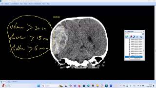 Case #1 (CT brain emergency)