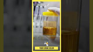 🔴URINE COLOR | What The Color Of Your URINE  Says About Your Health. #viral #viralvideo #shorts