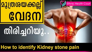 How to identify Kidney stone pain | മൂത്രശയക്കല്ല് കൊണ്ടുണ്ടാകുന്ന വേദന എങ്ങനെ തിരിച്ചറിയാം ?