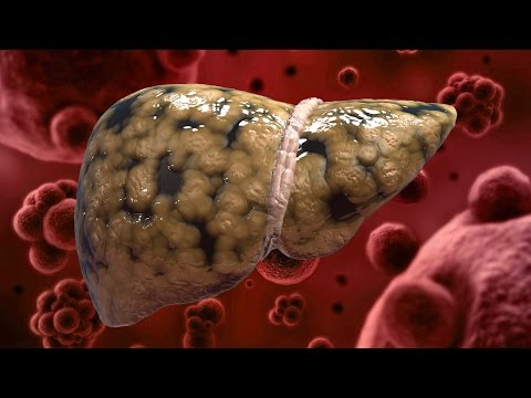 6 Foods That Naturally Cleanse the Liver 6 Foods That Naturally Cleanse the Liver