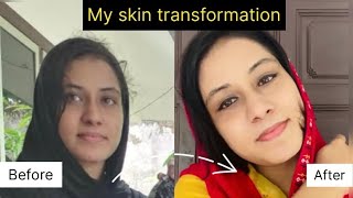 എന്റെ പൊന്നോ😱എങ്ങനെ ഇത്രയും Change ആയി 🔥🤩Skin transformation #shortvideo #skincare