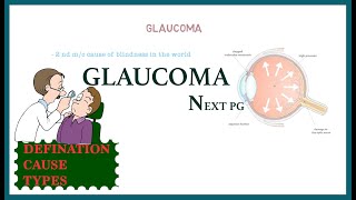 BASICS OF GLAUCOMA | GLAUCOMA INTRODUCTION | NEXT PG| NEET PG