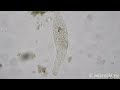 a ciliate devours a rotifer Зверский аппетит хищной инфузории