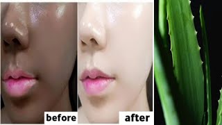 The Japanese secret to whitening the skin 10 colors and removing pigmentation and melasma