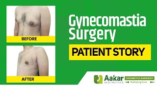 Gynecomastia Surgery By Kiran Nerkar |  Patient Story | 2022 | Aakar Hospital