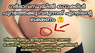 ഗർഭാവസ്ഥയിൽ പൊക്കിൾ പുറത്തേക്കു വരുന്നത് എന്തിന്റെ ലക്ഷണം 🤔 when belly button come out in Pregnancy