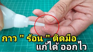 กาวร้อน ติดมือ นำออกได้ วิธีนี้ออกง่ายมาก