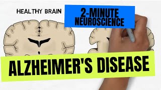 2-Minute Neuroscience: Alzheimer's Disease