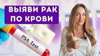 Распознай рак на ранней стадии с помощью анализа крови! Эти онкомаркеры помогут!