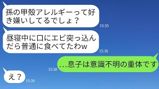 アレルギーを理解しない義母が、甲殻類アレルギーの息子の口に生エビを押し込んで緊急入院になった…→全く反省しない義母に、嫁の私は本気で怒った結果…www