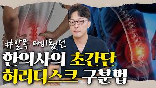 발목 마비를 극복한 한의사가 알려주는 허리디스크 초간단 구분법 | 묵직하고 뻐근한 허리, 디스크일까? 단순 통증일까? (국대 팀닥터 김규형 원장) [한방있규형]