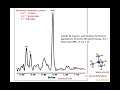 51. MR spectroscopy in clinical practice; choline, creatine, NAA, chemical shift, metabolites, MRS