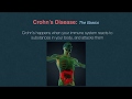 Crohn's Disease Part 1