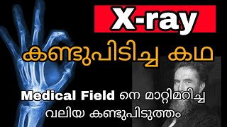 The story of the invention of X-rays | ലോകത്തെ അമ്പരപ്പിച്ച കണ്ടുപിടിത്തം