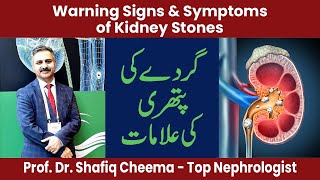 Warning Signs \u0026 Symptoms of Kidney Stones | Treatment of Stones #kidneystone #bestnephrologist