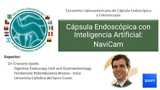 Cápsula Endoscópica con Inteligencia Artificial: Navicam