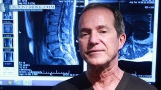 Endoscopic Discectomy Versus Fusion by Dr. Tony Mork