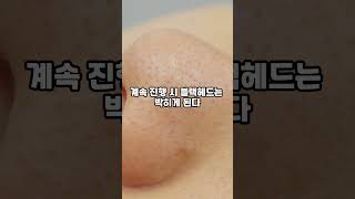 블랙헤드 제거 코팩이 효과 있는 유형 #shorts #블랙헤드 #블랙헤드관리 #블랙헤드제거 #kbeauty #K코팩 #블랙헤드제거코팩 #코팩 #코팩이효과없는이유