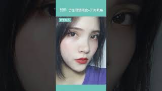 仿生理雙眼皮案例分享 #雙眼皮手術 #雙眼皮重修 #doubleeyelid