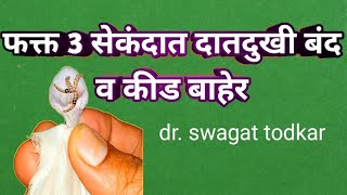 मिनिटात दातदुखी बंद व दातातील घाण बाहेर घरचा रामबाण उपाय relif of teeth problems dr. todkar