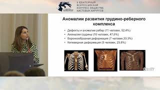 Агранович О.Е.: применение лоскута на основе широчайшей мышцы спины у больных с синдромом Поланда.