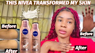 HOW I REPAIRED MY SKIN WITH NIVEA RADIANT AND BEAUTY EVEN GLOW LOTION | NIVEA CREAM FOR FAIR SKIN