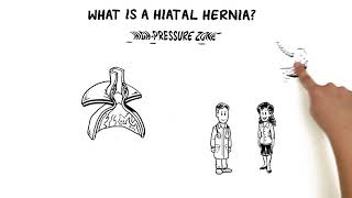 What Is A Hiatal Hernia