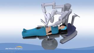 Robotic Single Incision Gallbladder Removal