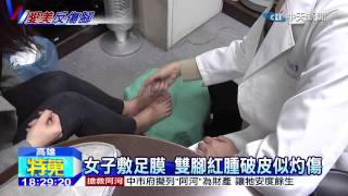 20141227中天新聞　女子敷足膜　雙腳紅腫破皮似灼傷