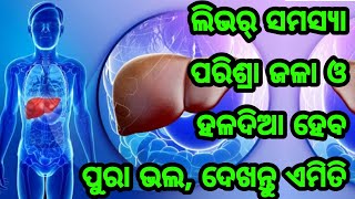 ପରିଶ୍ରା ହଳଦିଆ, ପୋଡା, ଲିଭର୍ ସମସ୍ଯା ଆଦି ଭଲ ହେବ ଏମିତି, ବାସ୍ କରନ୍ତୁ ଏହି ଘରୋଇ ଉପଚାର