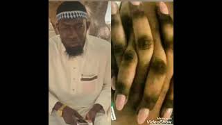 Ruling on changing the colour of the skin from dark to whiteheikh Fakebba Ceesay HAFIZAHOULAH