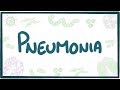 Pneumonia - causes, symptoms, diagnosis, treatment, pathology Pneumonia - causes, symptoms, diagnosis, treatment, pathology
