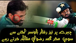 Muhammad Rizwan has swelling on face || رضوان کے چہرے پر سوجن#Cricket #pakistan #highlights#rizwan