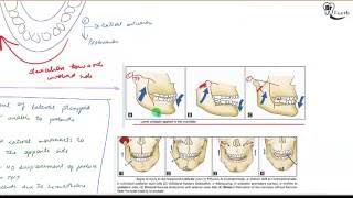 Condyle fracture- Oral surgery